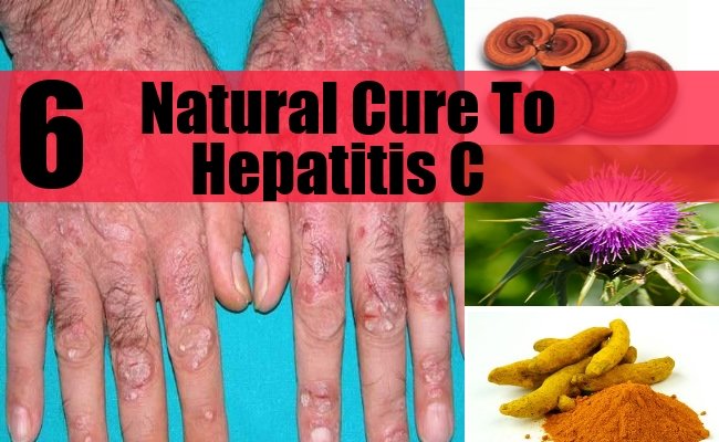 6 Natural Cure For Hepatitis C