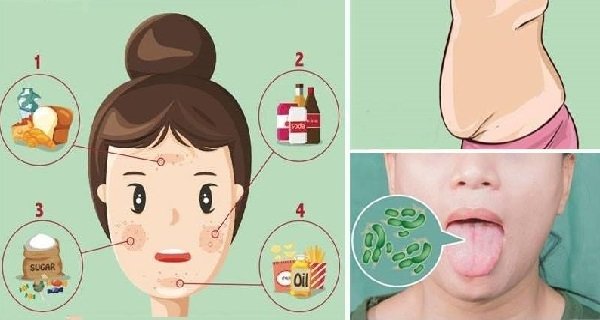 7 Signs That Scream You Need Getting Rid Of Toxins In Your ...
