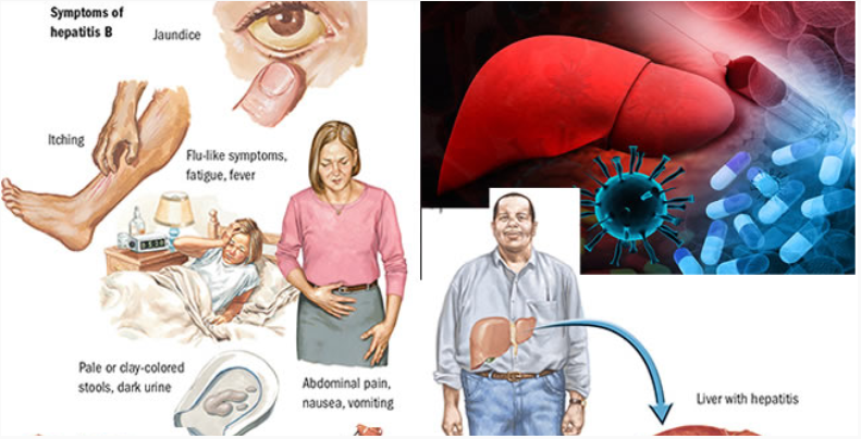 8 symptoms of hepatitis B you mustnt ignore