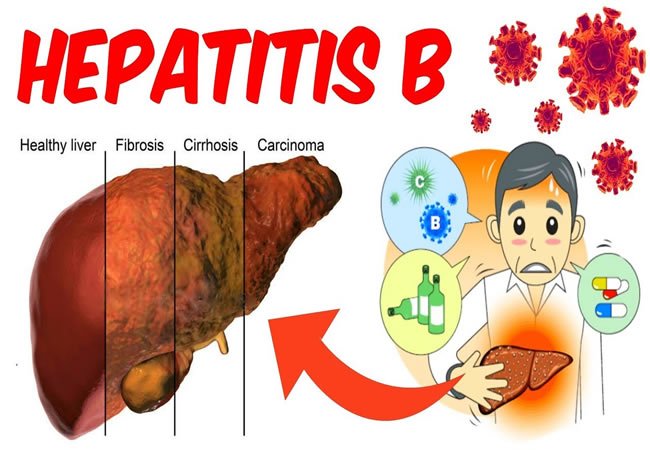 9 common ways people spread hepatitis B virus