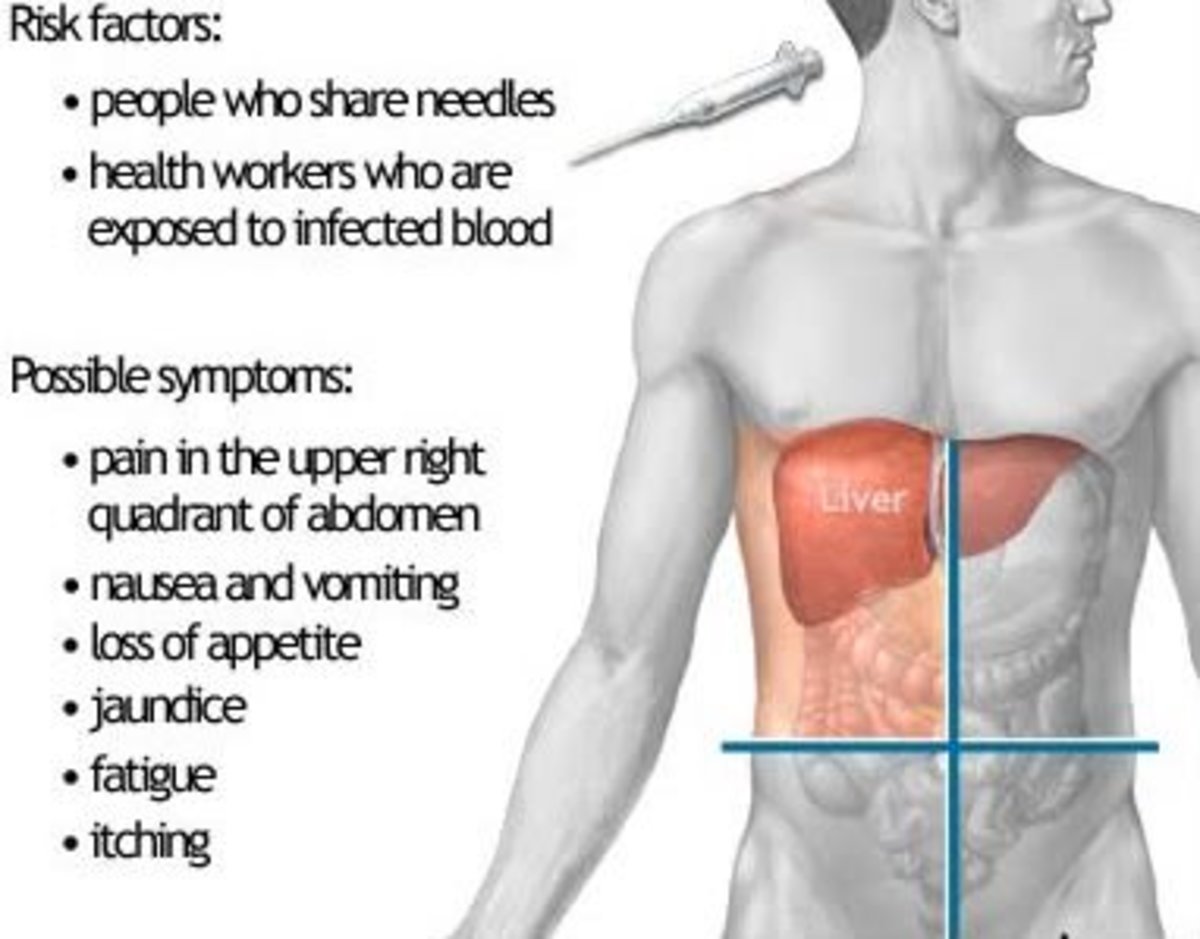Autoimmune Hepatitis Causes Cirrhosis of the Liver