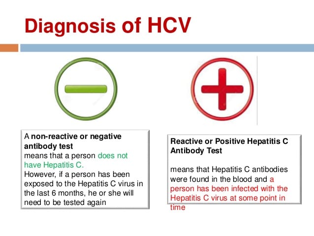 Basics of Hepatitis C