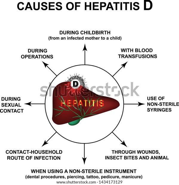 Causes Hepatitis D World Hepatitis Day Stock Vector (Royalty Free ...