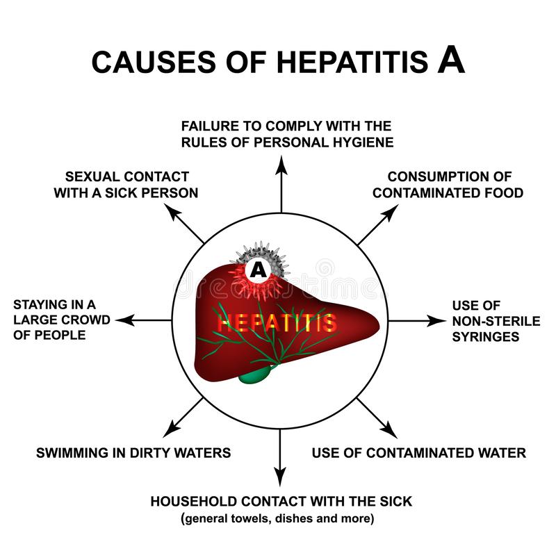 Causes of Hepatitis a. World Hepatitis Day. Infographics. Vector ...