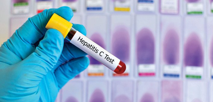 Clinics Need to Increase HIV and Hep C Testing for People ...
