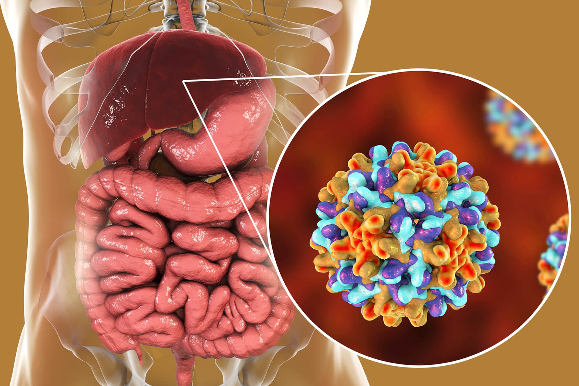 Colorectal Liver Metastasis Linked to Chronic Hepatitis B ...