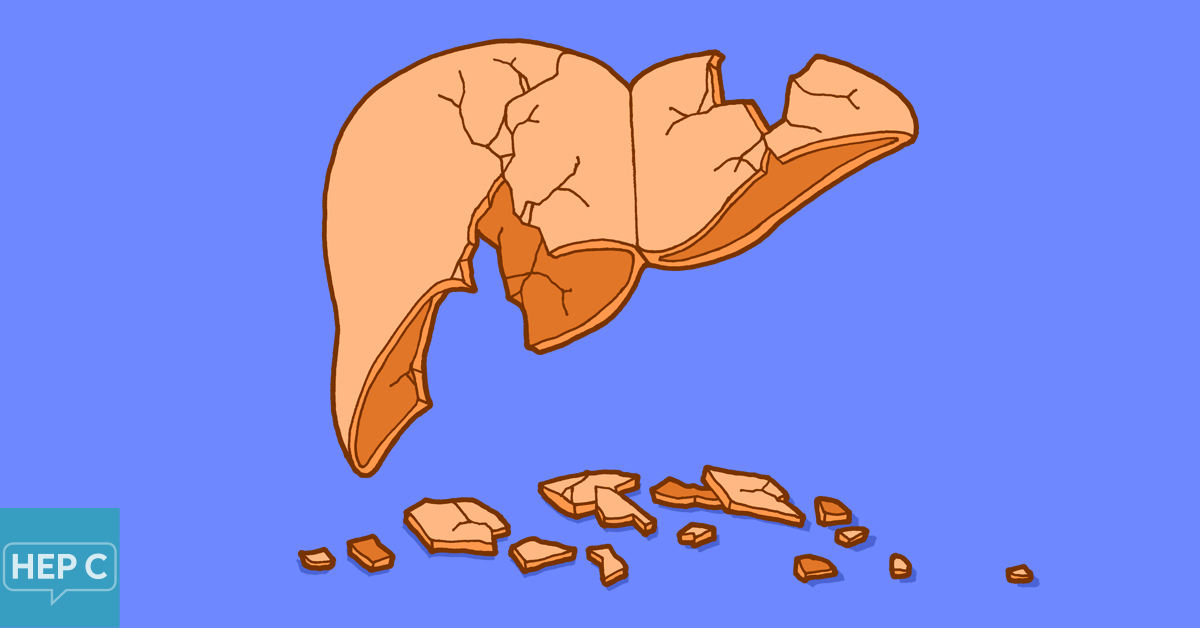 Common Causes of Liver Damage