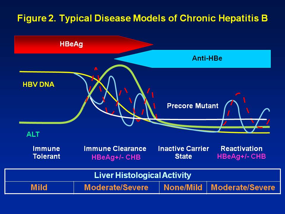 Diagnosed With Chronic Hepatitis B? What Phase