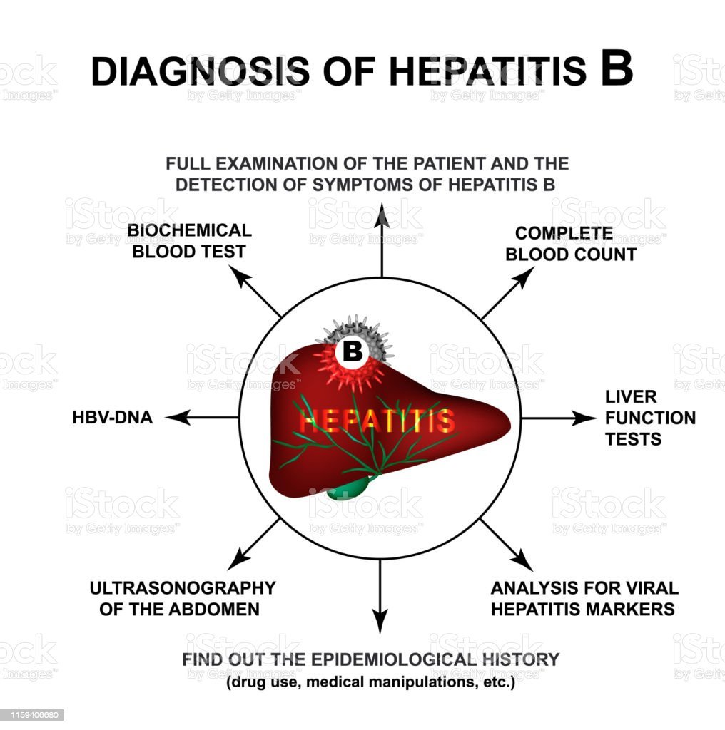 Diagnosis Of Hepatitis B. World Hepatitis Day. Infographics. Vector ...