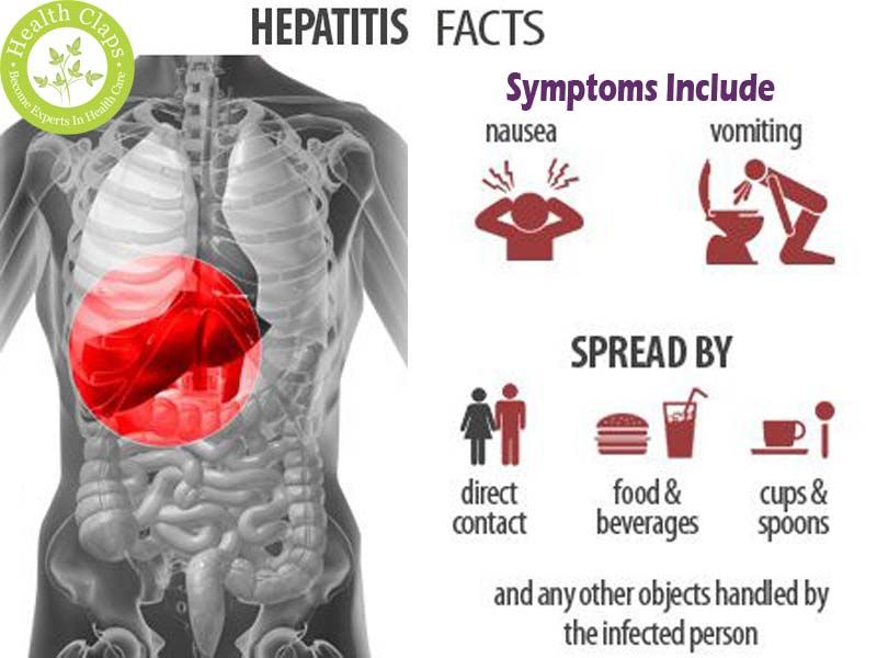 Die besten 25+ Hepatitis c symptome Ideen auf Pinterest ...