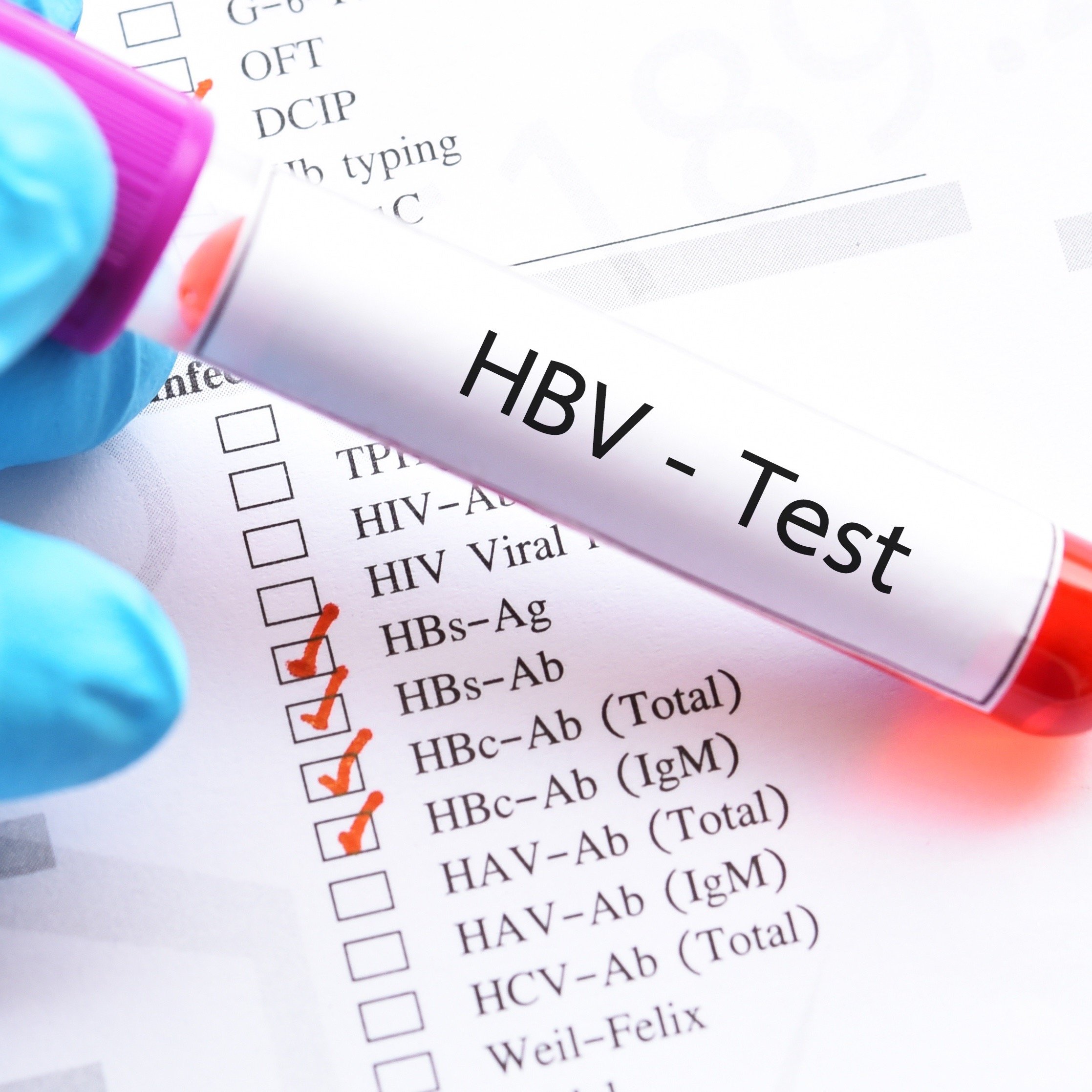 Do You Know the Differences Between Hepatitis A, B and C ...