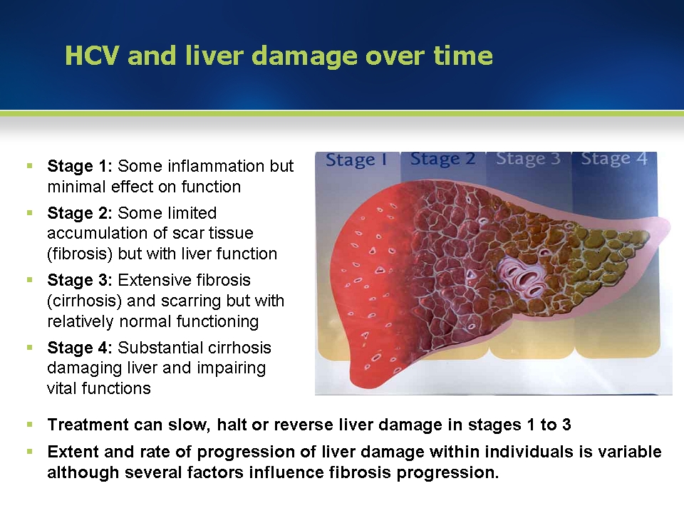 Does Hep C Cause Liver Cancer