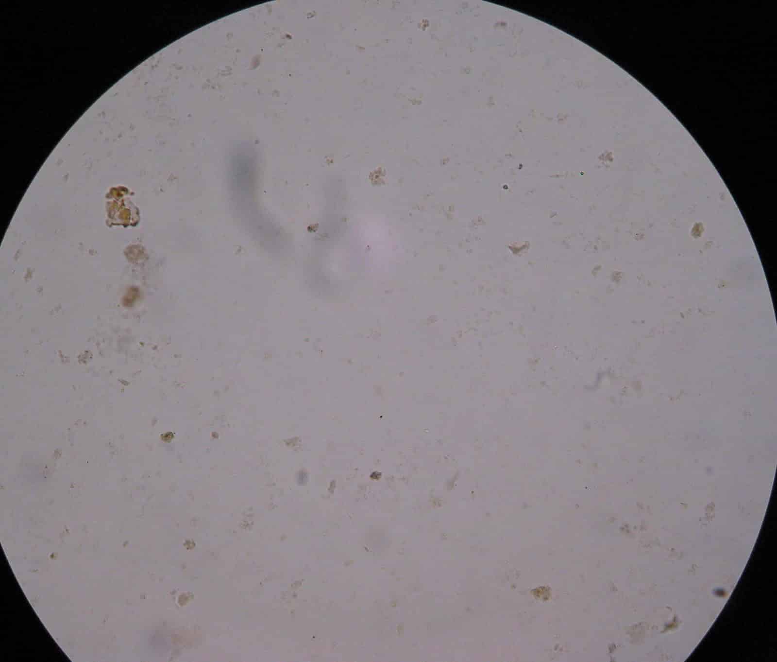 DVC Microbiology 146 Fall 11 (Gard): Lab 38 Pathogens