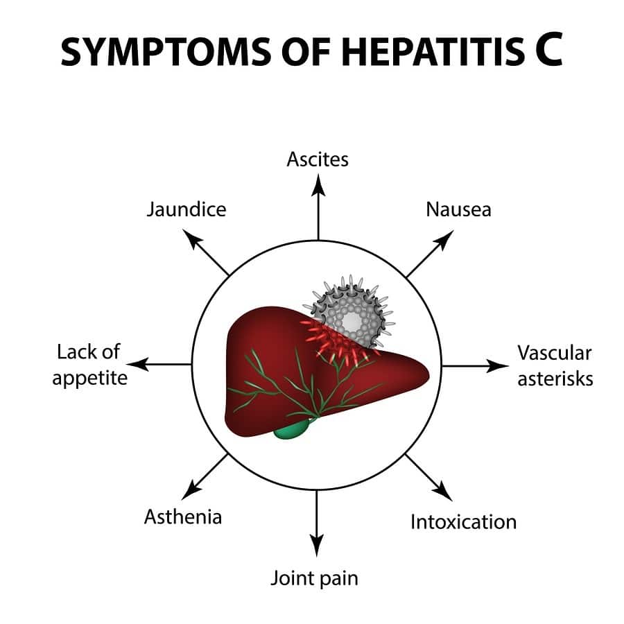 Early Signs And Symptoms Of Hepatitis C