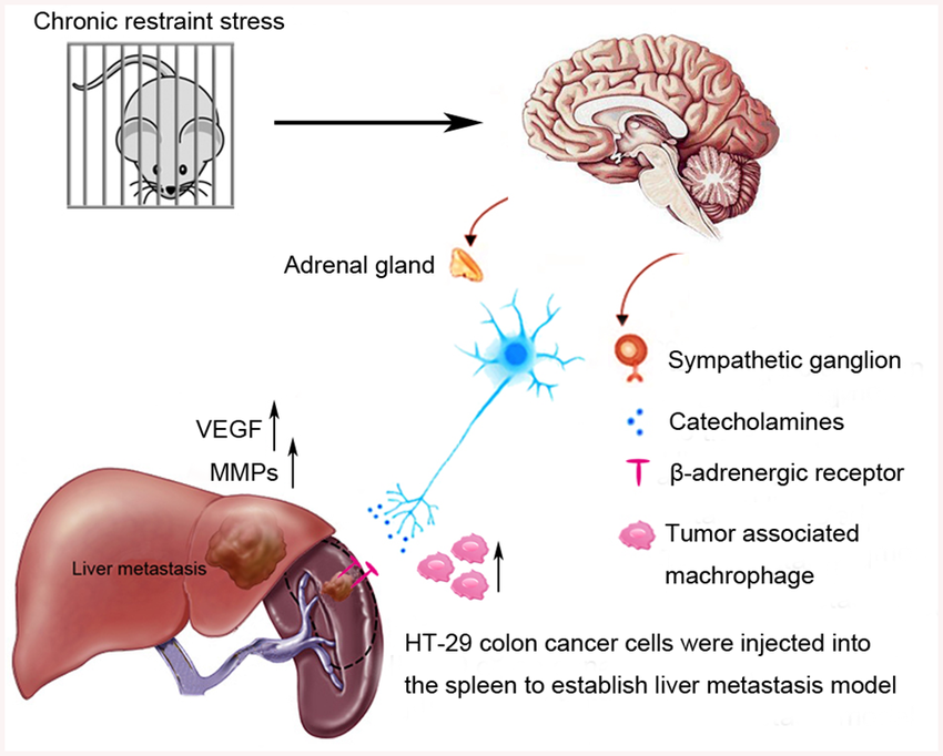Effect of chronic psychological stress on liver metastasis ...