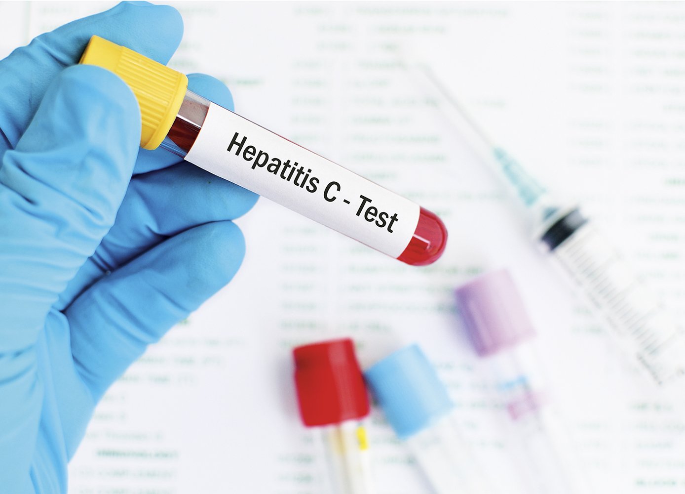 Experts Advise Expanded Hep C Screening