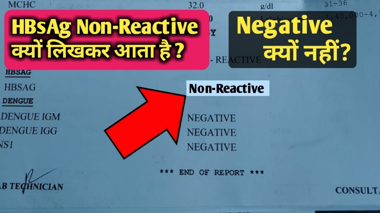 HBsAg Non Reactive Meaning l Non Reactive Test results l HBsAg Negative ...