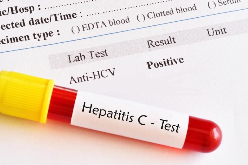 HCV Test