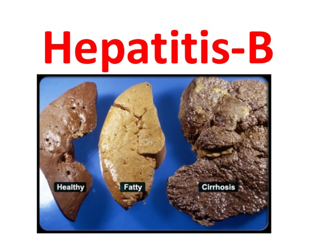 Health Check  Hepatitis B