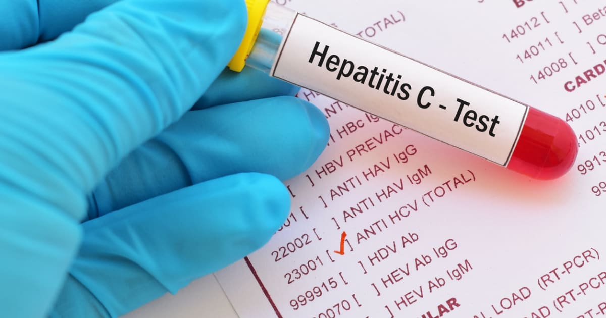 Hep C Test Results Not Detected What Does That Mean