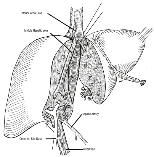 Hepatic Resections