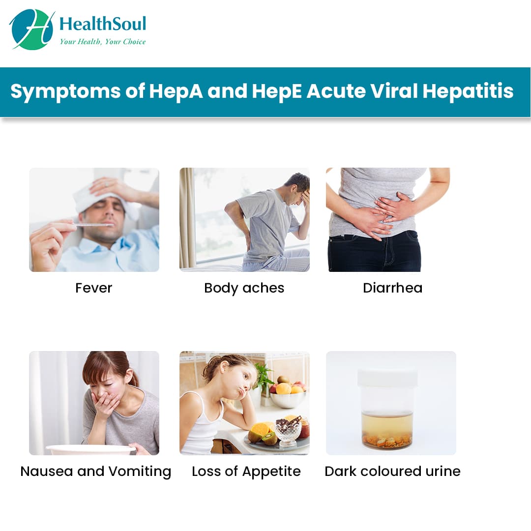 Hepatitis A and E Acute Viral Infections â Healthsoul