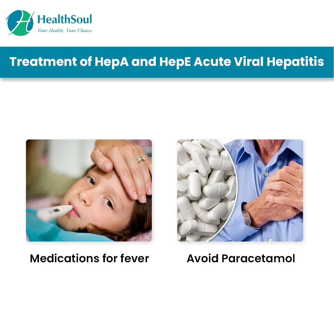 Hepatitis A and E Acute Viral Infections  Healthsoul