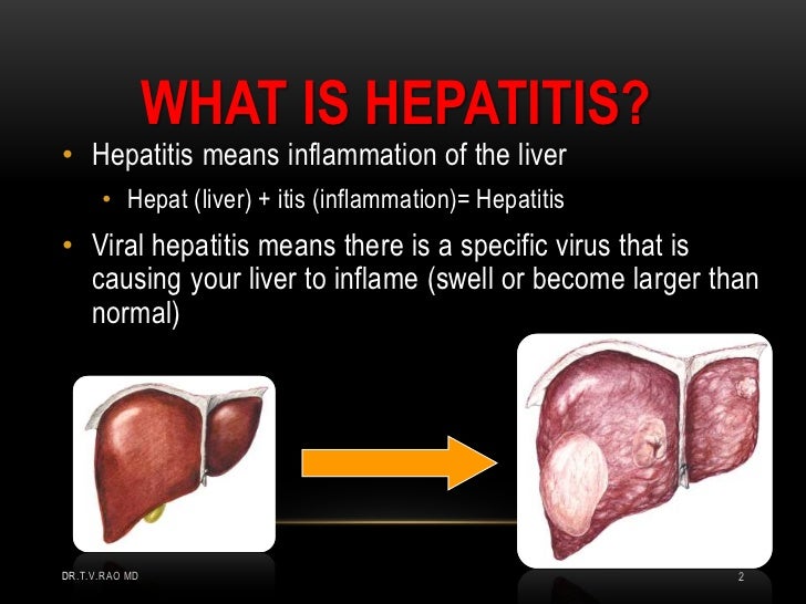 Hepatitis A Infection