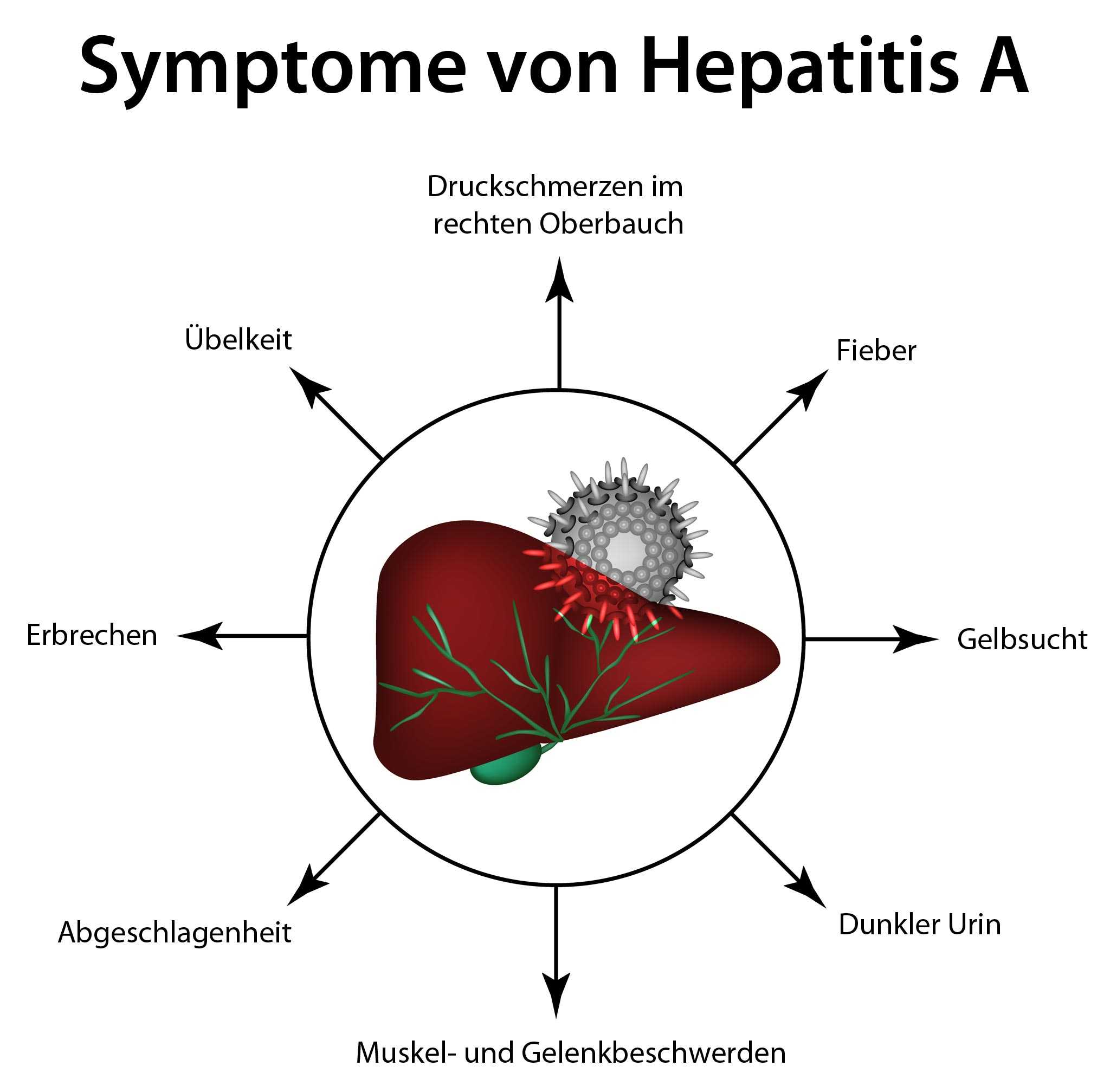 Hepatitis A / Sedgwick County Has Outbreak Of Hepatitis A Virus Amid ...
