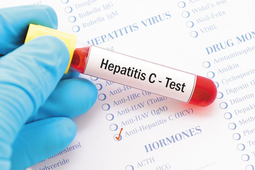 Hepatitis: Avoid contaminated food, water, unprotected sex ...