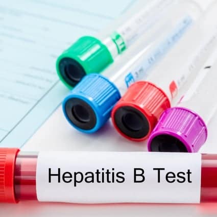 Hepatitis B cure research: health organisations, patient groups ...