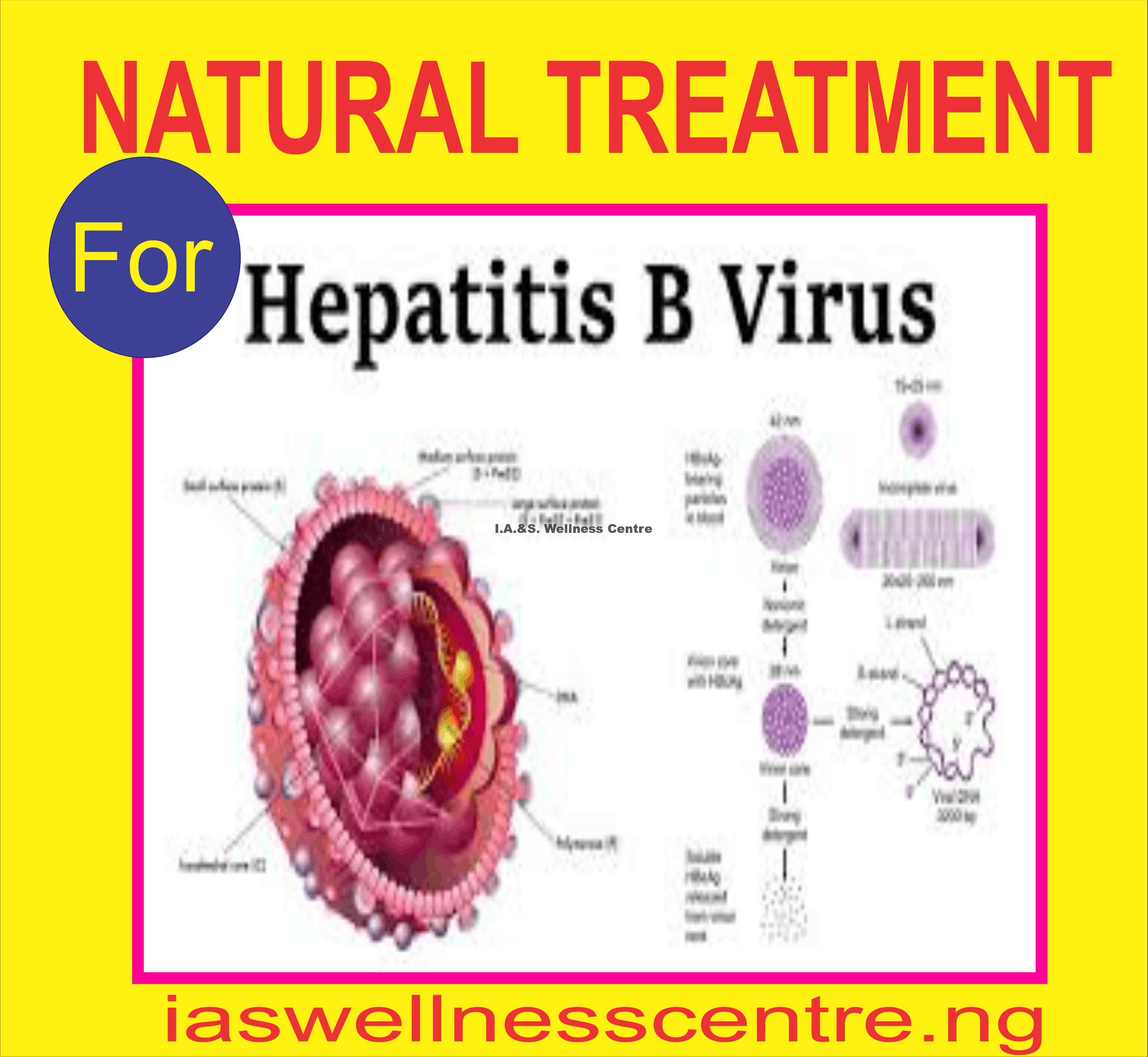 HEPATITIS B (HBV) AND ITS NATURAL TREATMENT IN NIGERIA  I.A.S ...