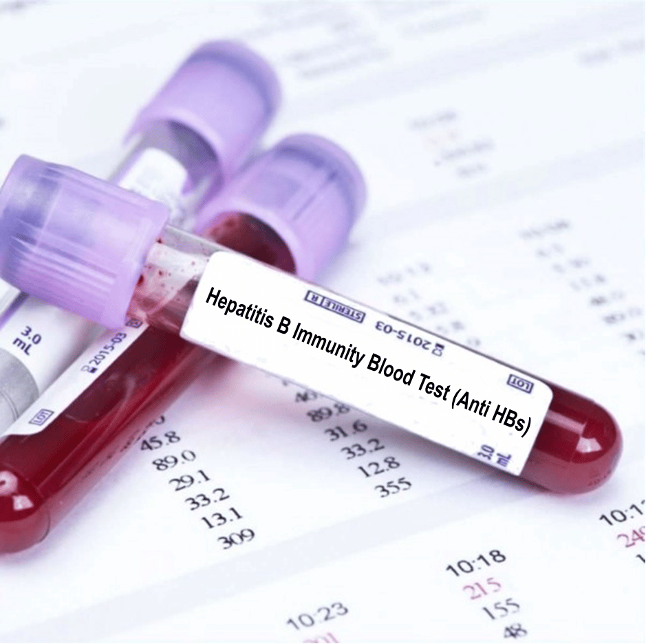 Hepatitis B Immunity Blood Test (Anti HBs)