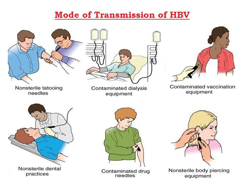 Hepatitis B : Sign &  Symptoms, Transmission, Risk factors, Diagnosis ...