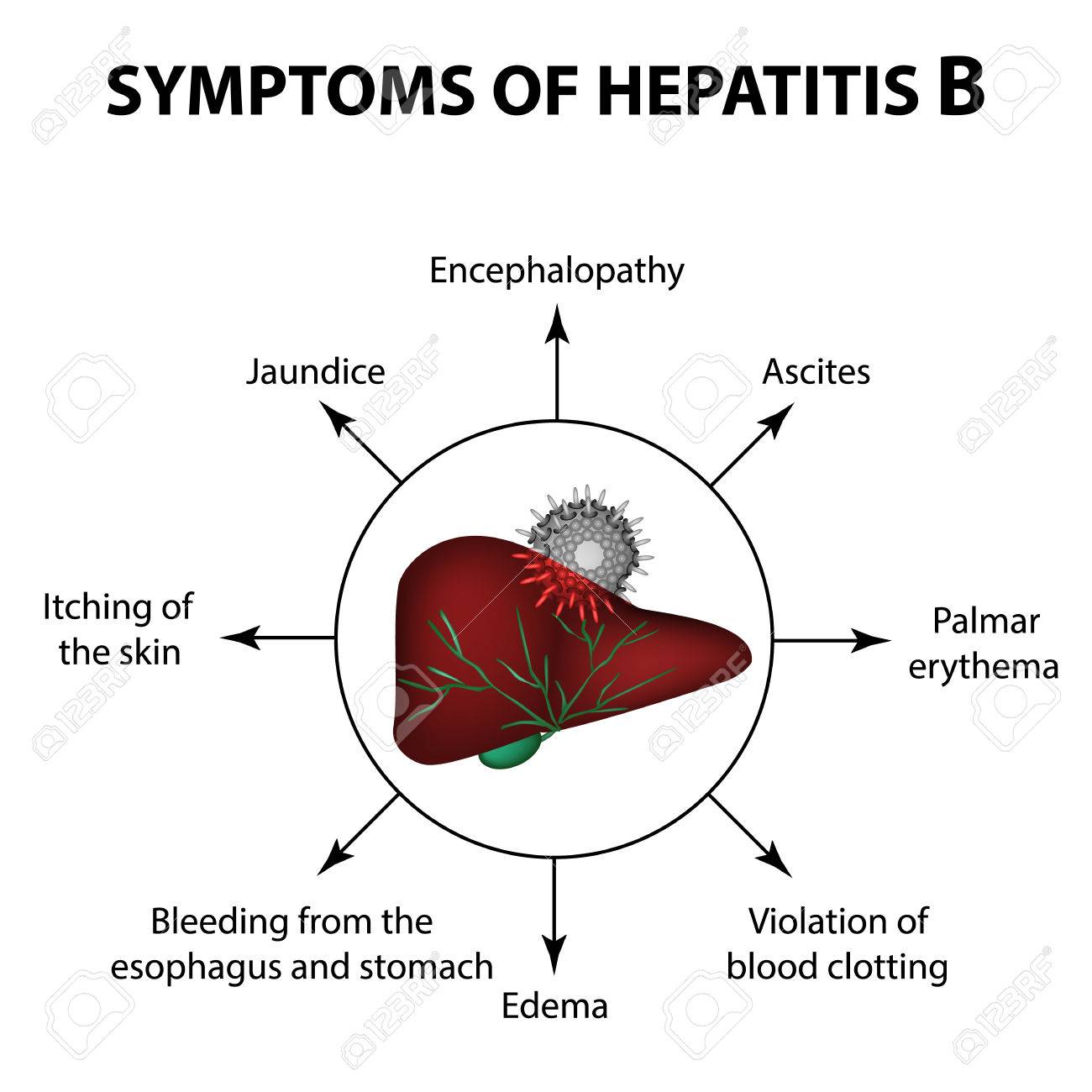HEPATITIS B SOLUTION ~ NATURAL HEALTH