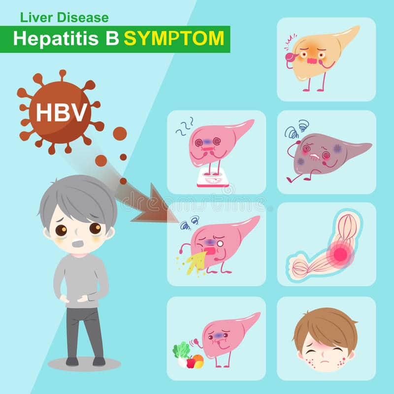 Hepatitis b symptom stock vector. Illustration of inject
