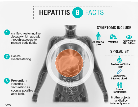 Hepatitis B: Symptoms, Diagnosis and Treatment