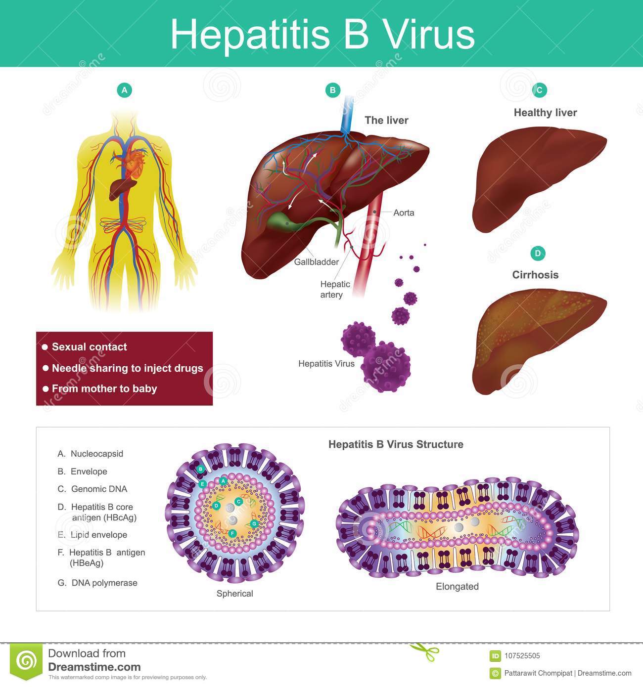 Hepatitis B Virus. the Virus is Mainly Transmitted by Sexual Con Stock ...