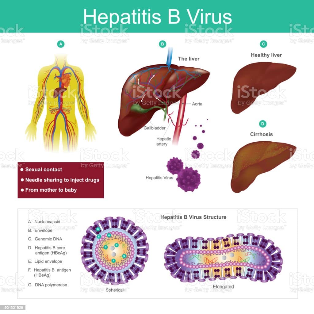 Hepatitis B Virus The Virus Is Mainly Transmitted By Sexual Contact ...
