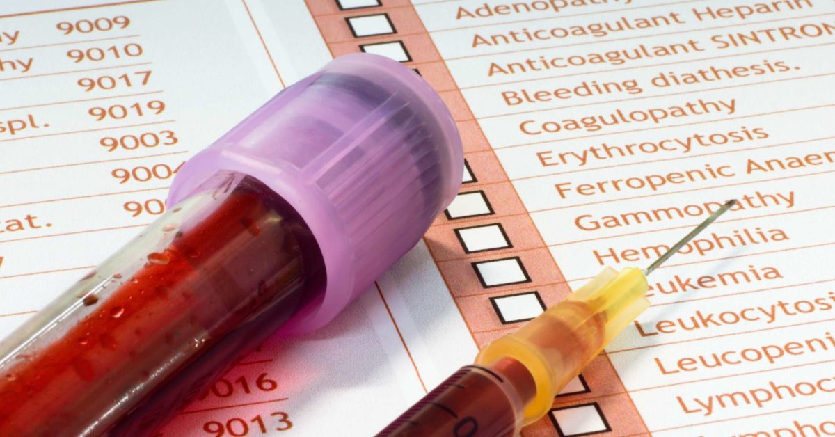 Hepatitis C antibody test: Results and what to expect