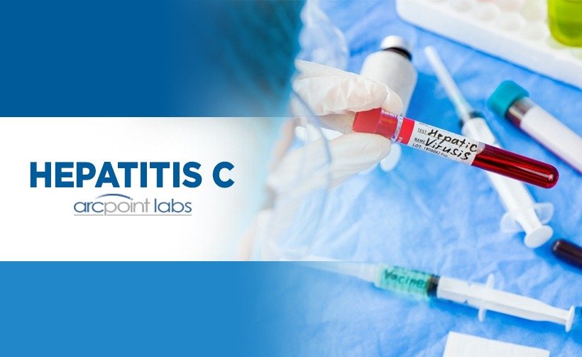 Hepatitis C Antibody with Reflex to HCV