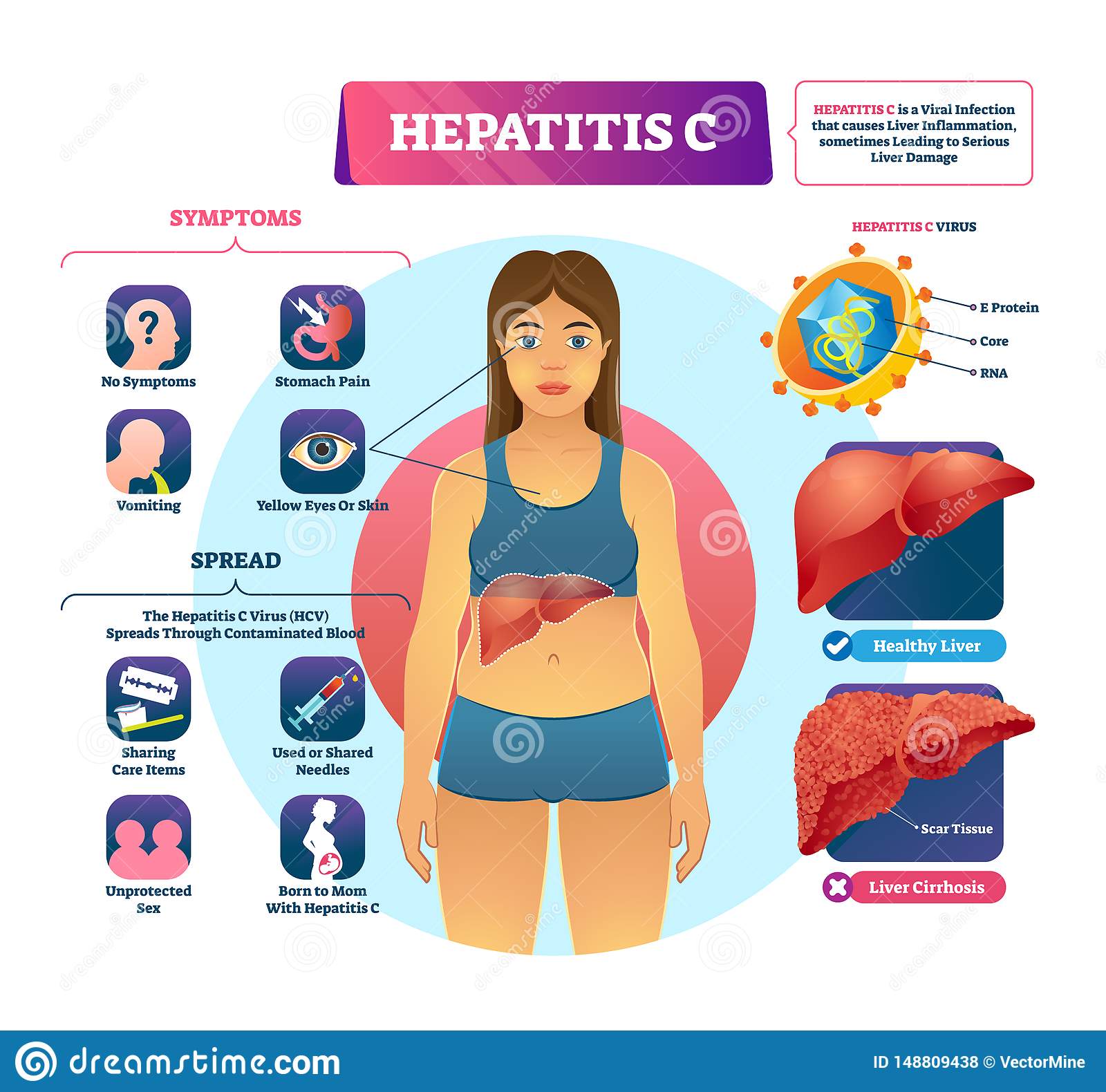 Hepatitis C Female Symptoms