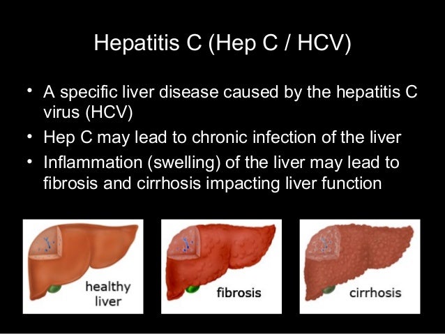 Hepatitis C &  HIV Co