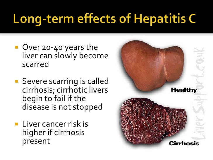 Hepatitis C Presentation for CHOW 2011