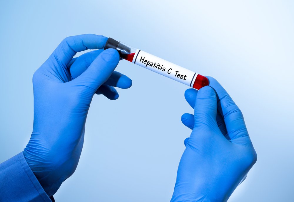 Hepatitis C: Rapid antibody test
