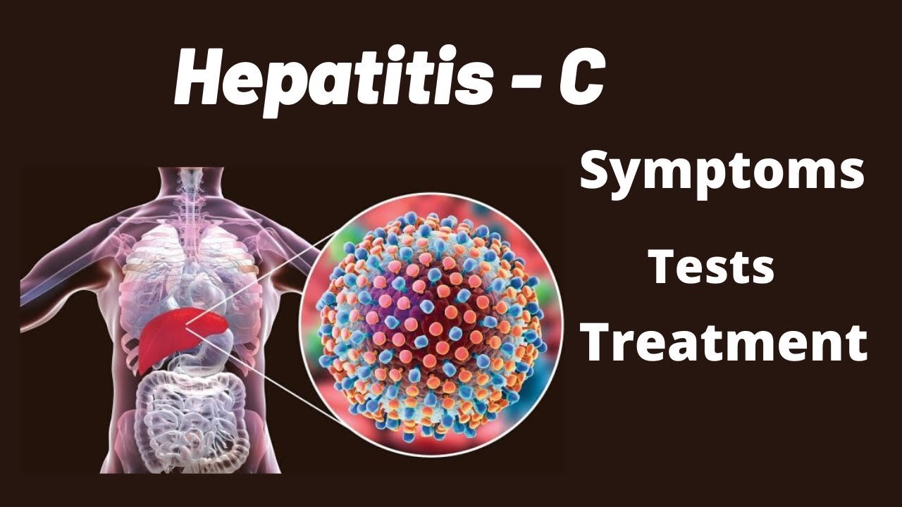hepatitis c symptoms in urdu