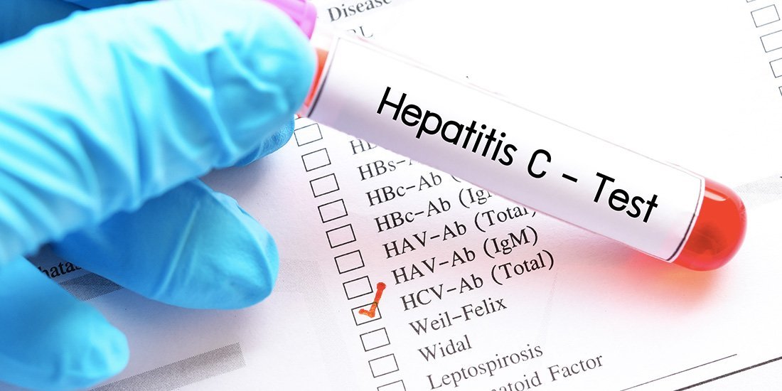 Hepatitis C Virus (HCV) Test
