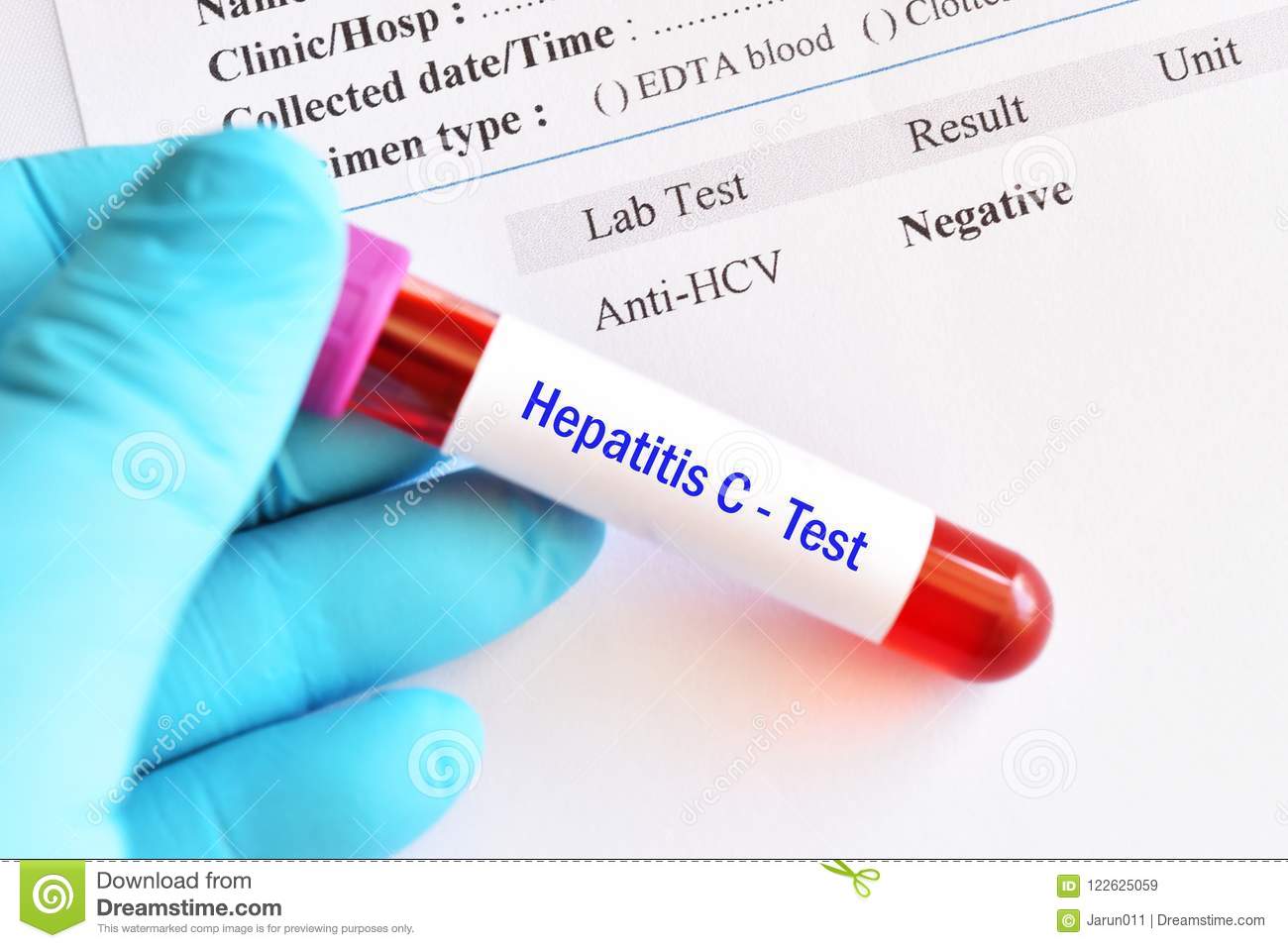 Hepatitis C Virus Negative Test Result Stock Image