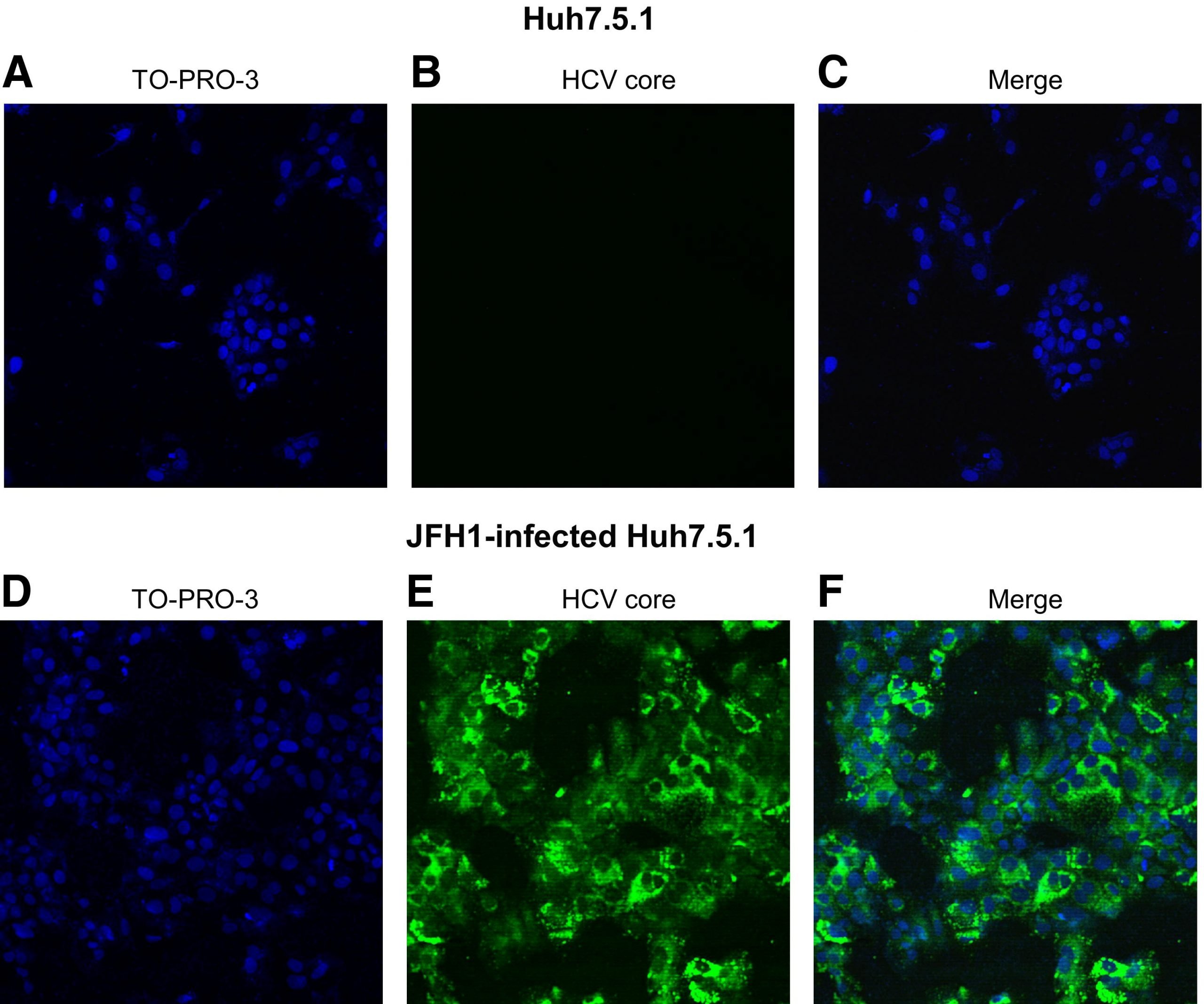 Hepatitis C Virus Regulates Transforming Growth Factor Î²1 Production ...