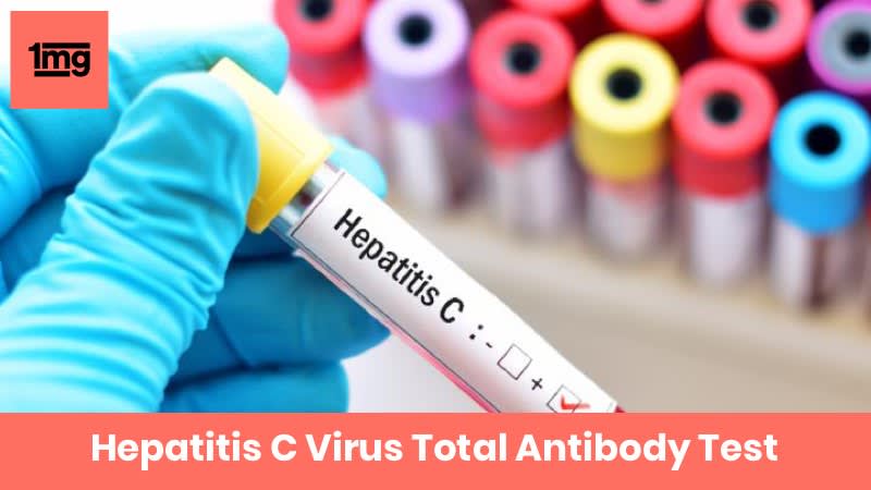 Hepatitis C Virus Total Antibody (HCV Ab): Purpose &  Normal Range of ...